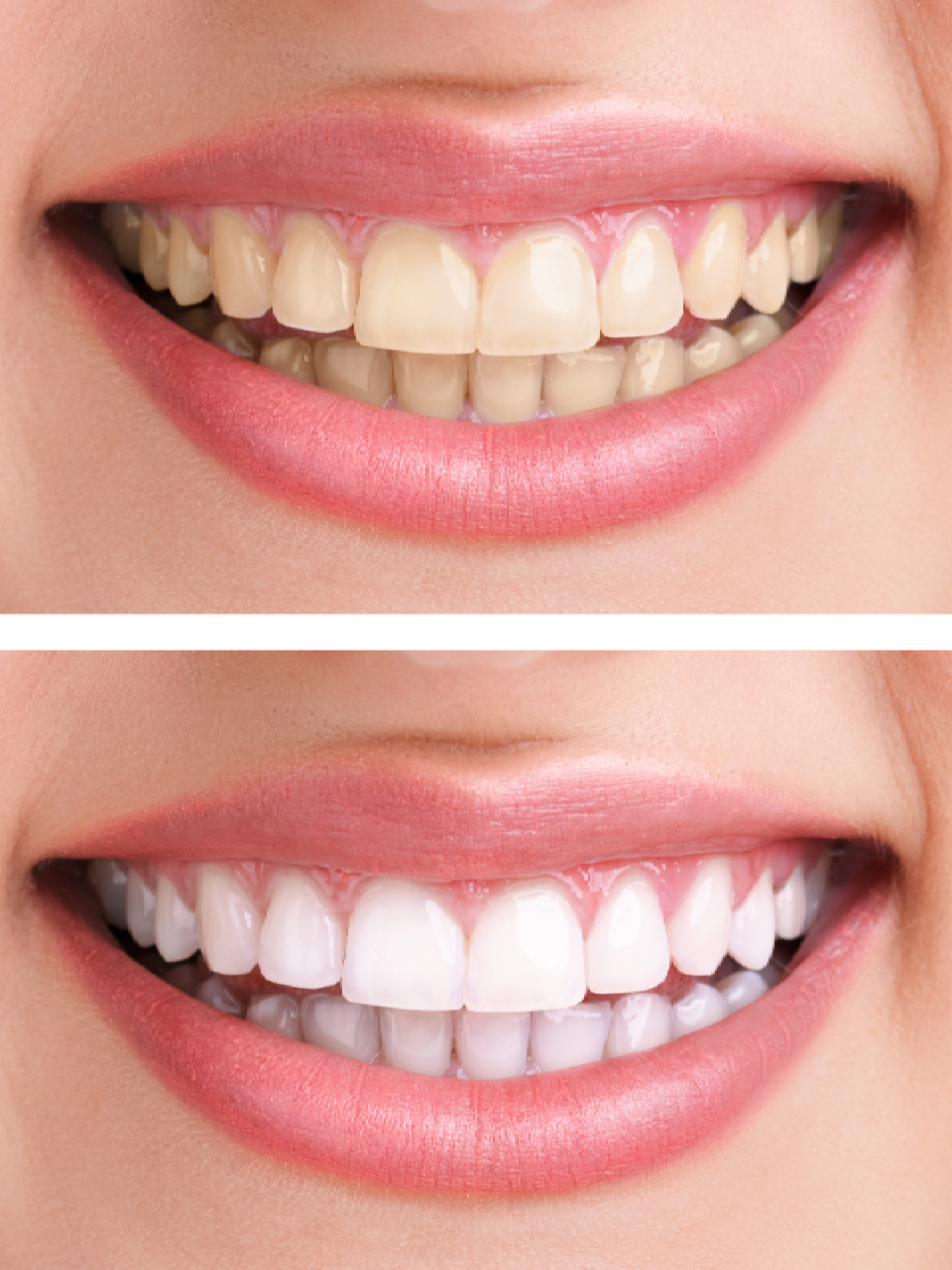 a close up of a woman's teeth