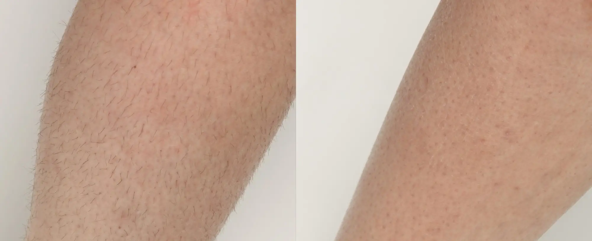 a close up of a person's leg