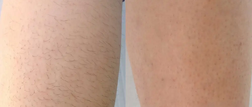 a close up of a person's legs